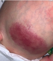 J Skin Stem Cell